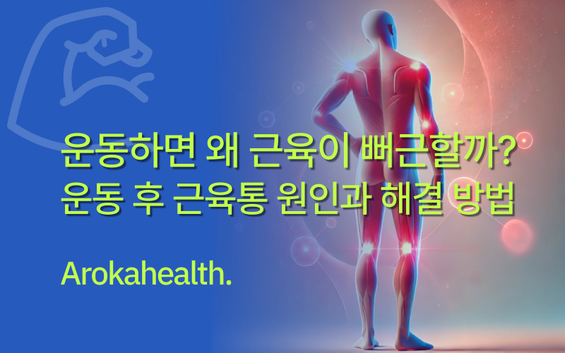 운동-후-근육통